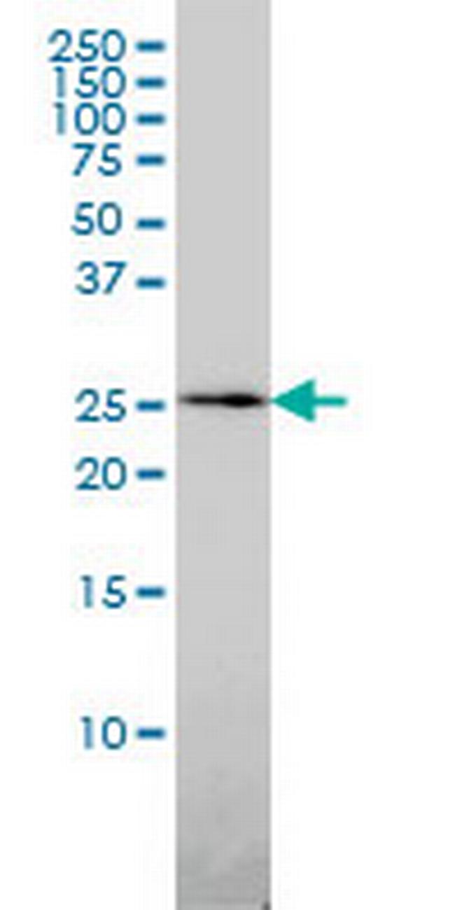 QDPR Antibody in Western Blot (WB)