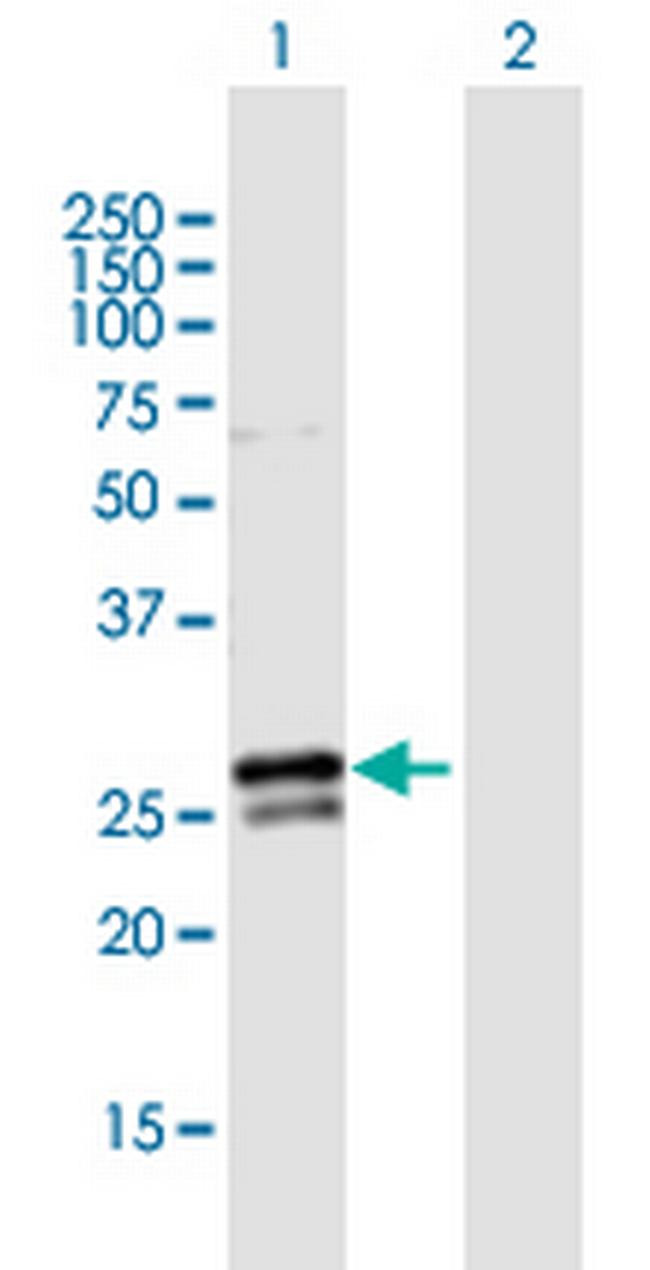 RAB3B Antibody in Western Blot (WB)