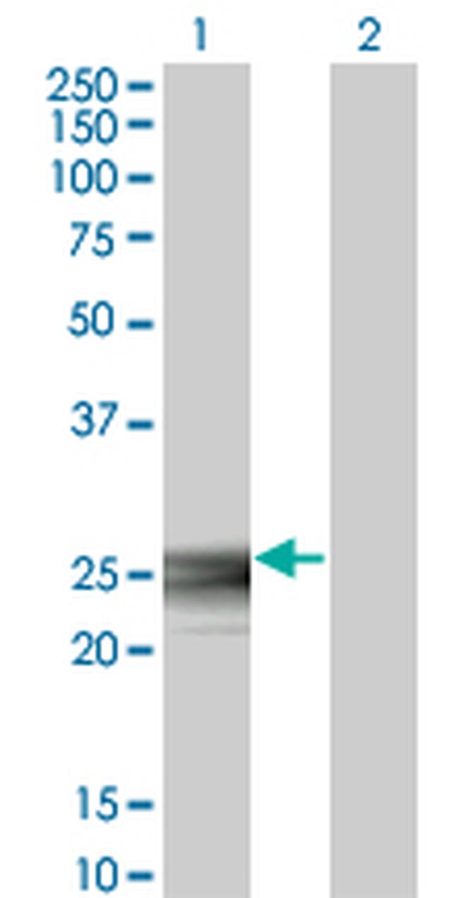 RAB3B Antibody in Western Blot (WB)