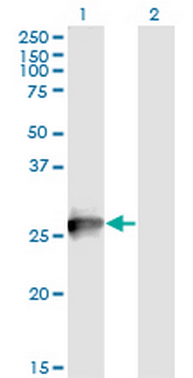 RAB3B Antibody in Western Blot (WB)