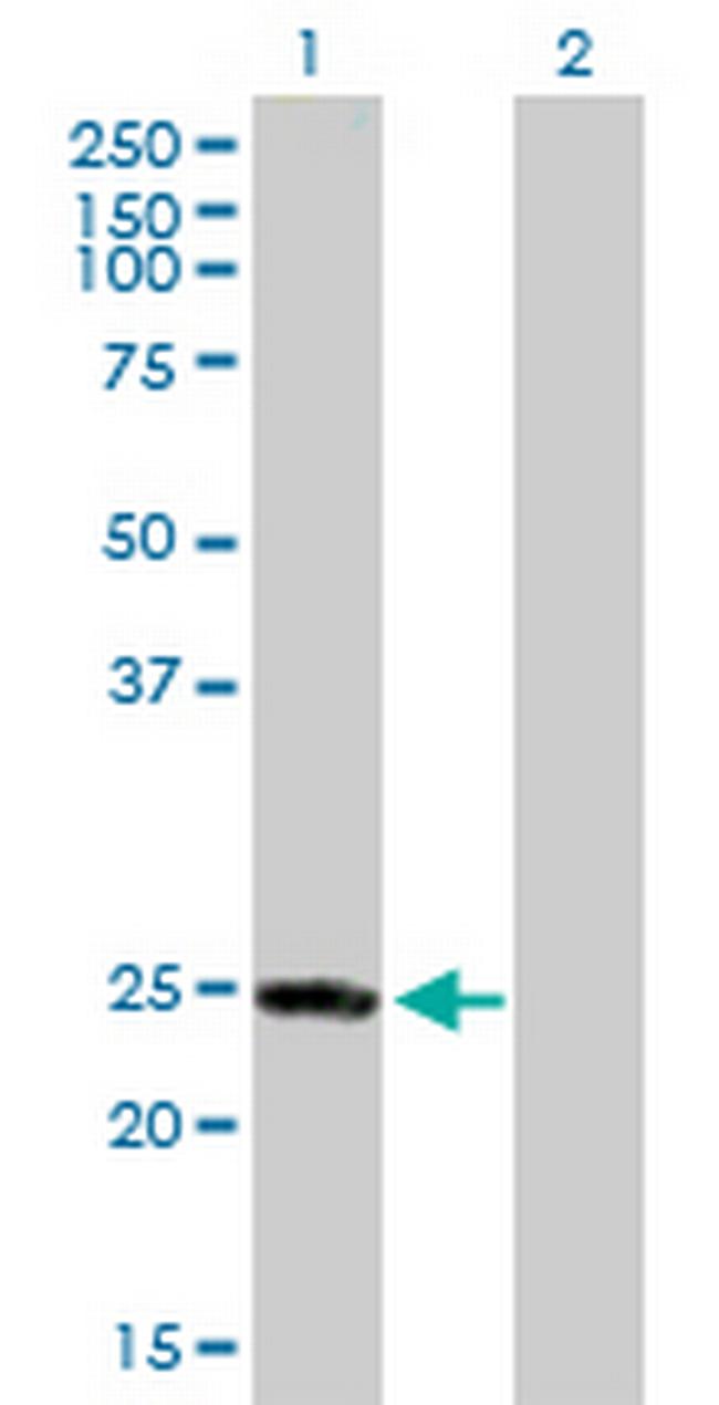 RAB4A Antibody in Western Blot (WB)