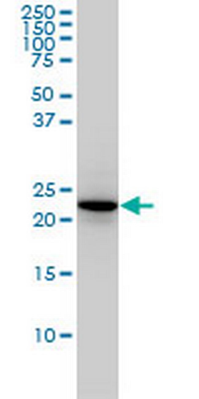 RAB4A Antibody in Western Blot (WB)