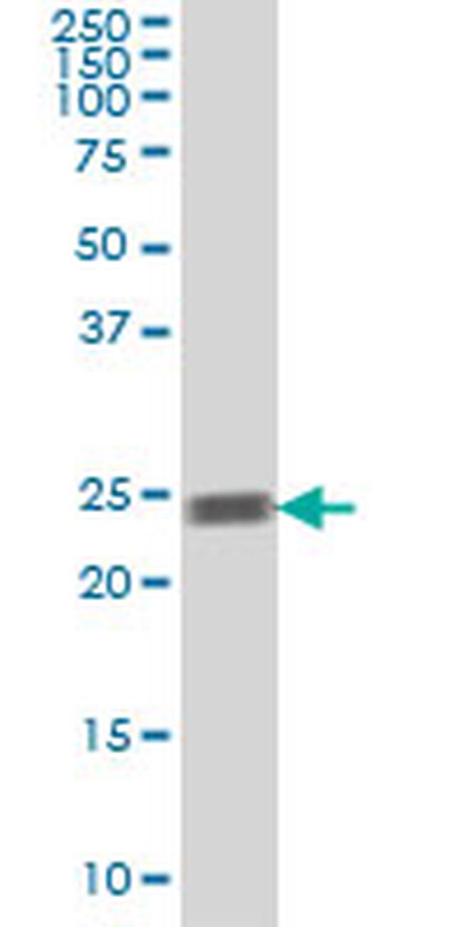 RAB5A Antibody in Western Blot (WB)