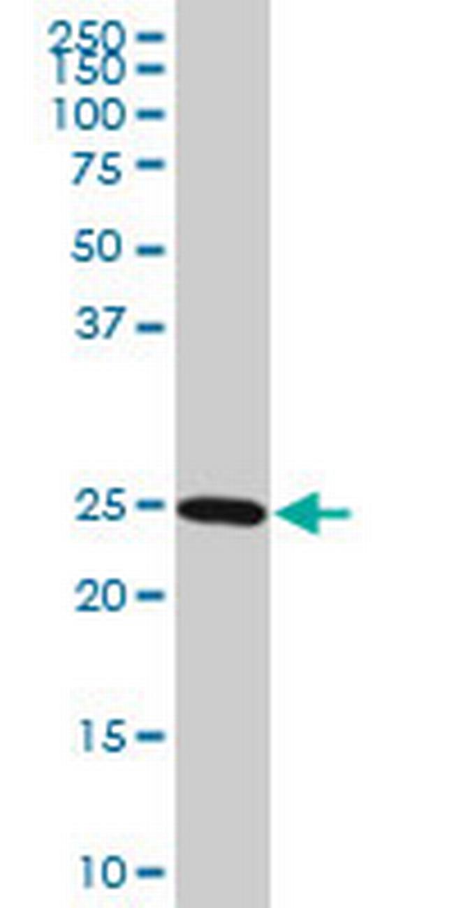 RAB27A Antibody in Western Blot (WB)