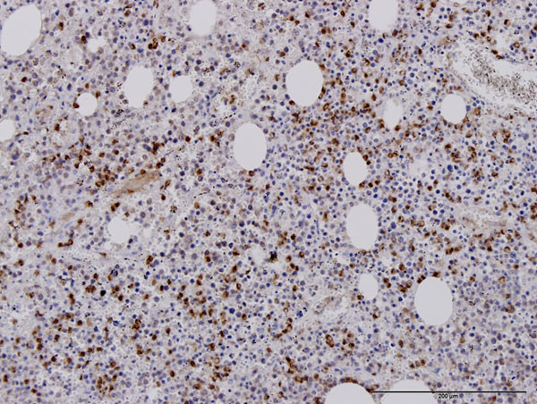 RAB27A Antibody in Immunohistochemistry (Paraffin) (IHC (P))