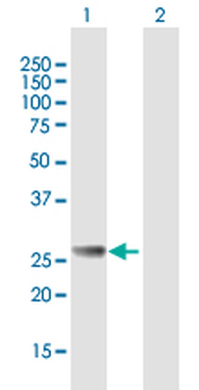 RAB27B Antibody in Western Blot (WB)