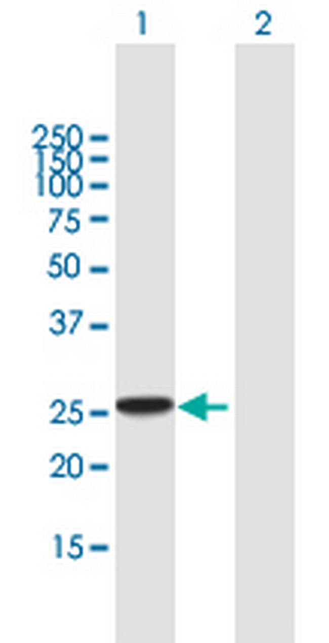 RAB27B Antibody in Western Blot (WB)