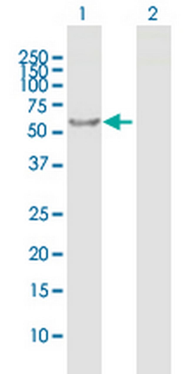 RABGGTA Antibody in Western Blot (WB)