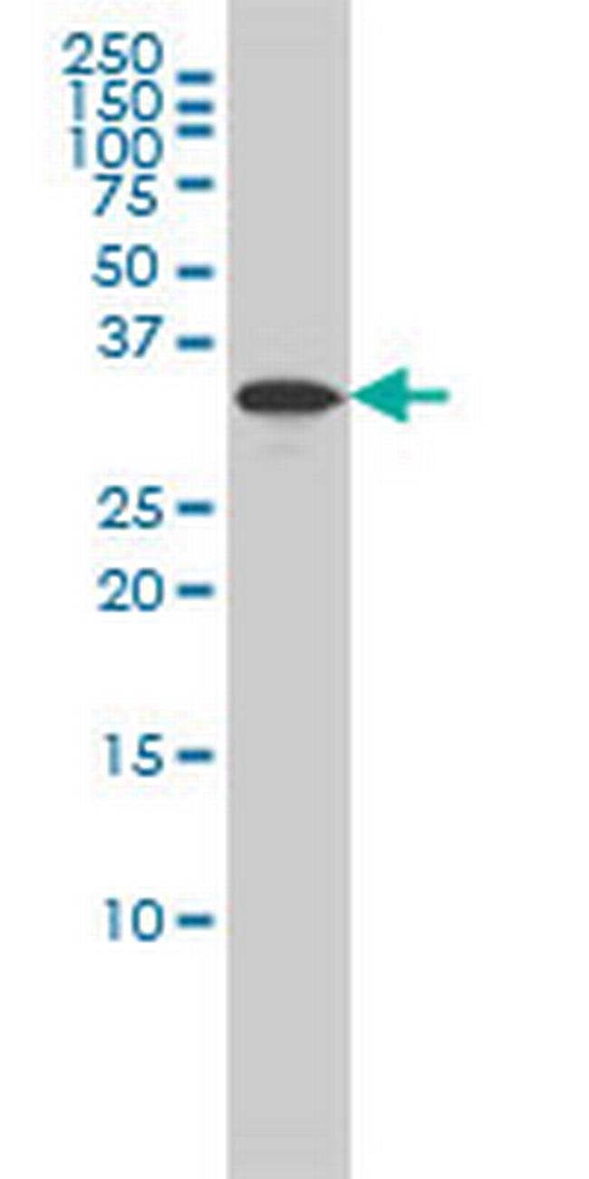 RABGGTB Antibody in Western Blot (WB)