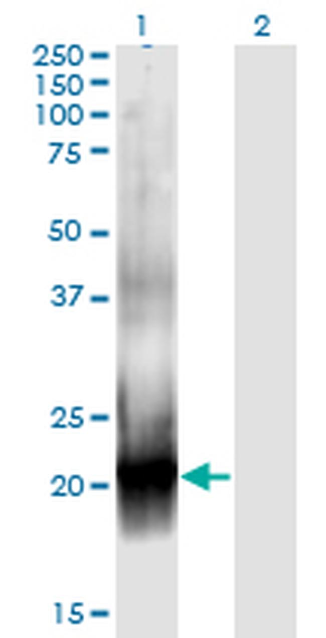 RAC2 Antibody in Western Blot (WB)