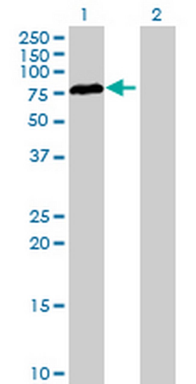 RAD17 Antibody in Western Blot (WB)