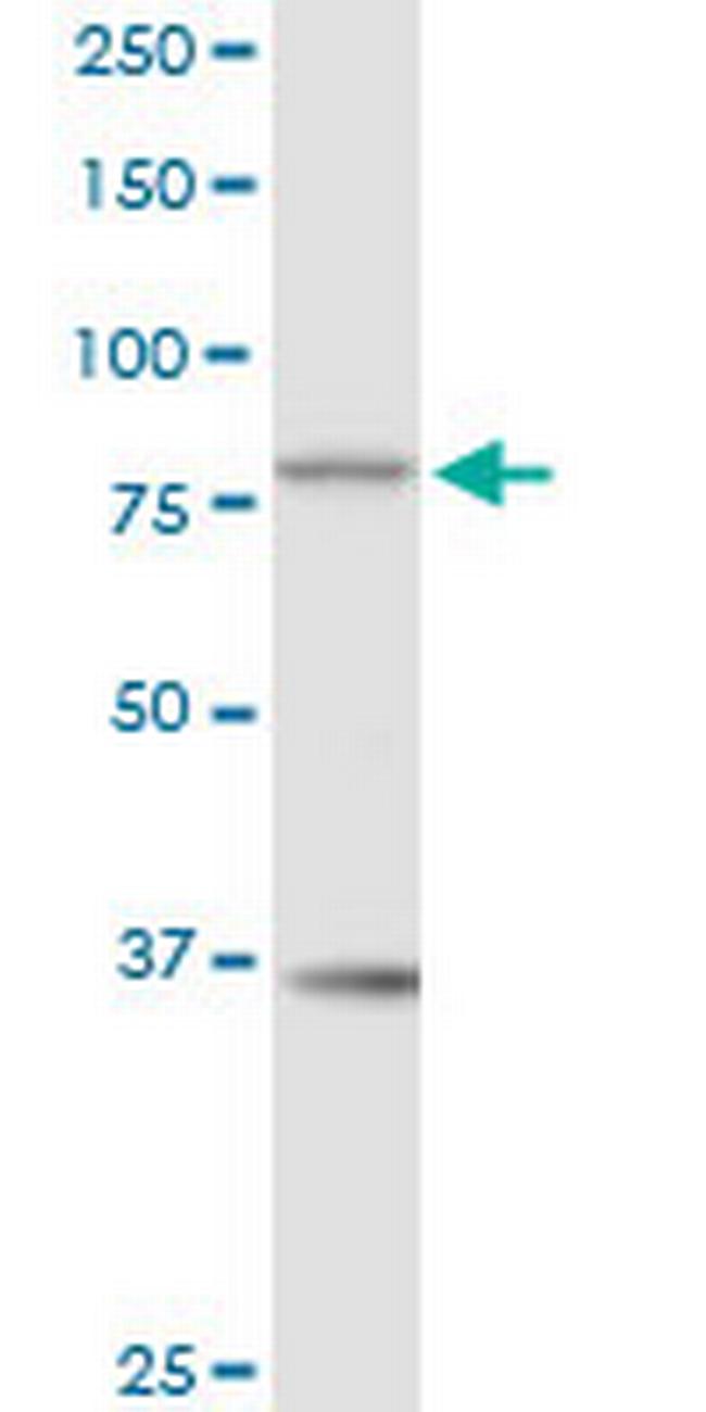 RAD17 Antibody in Western Blot (WB)