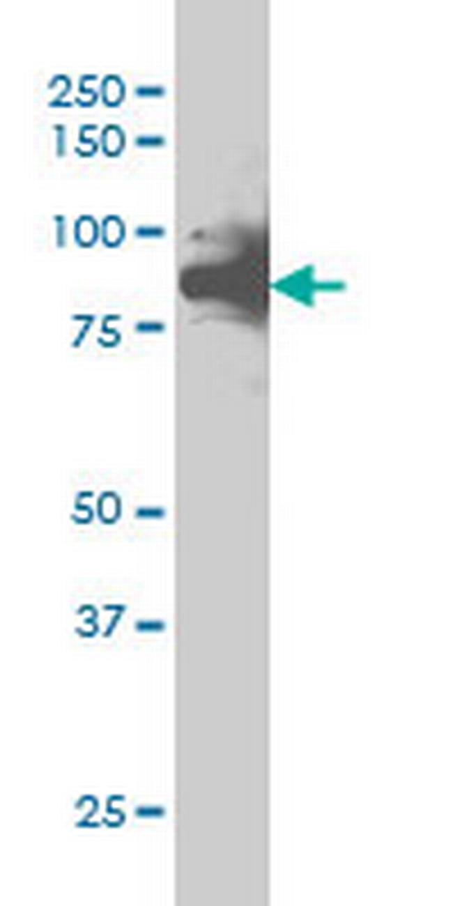 RAD17 Antibody in Western Blot (WB)