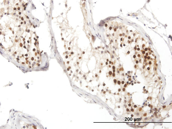 RAD51 Antibody in Immunohistochemistry (Paraffin) (IHC (P))