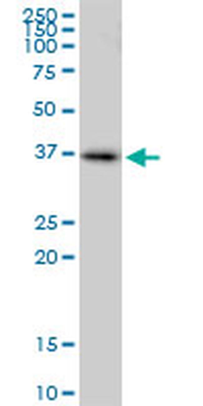 RAD51 Antibody in Western Blot (WB)