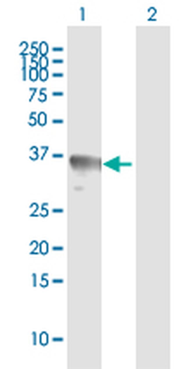 RAD51 Antibody in Western Blot (WB)