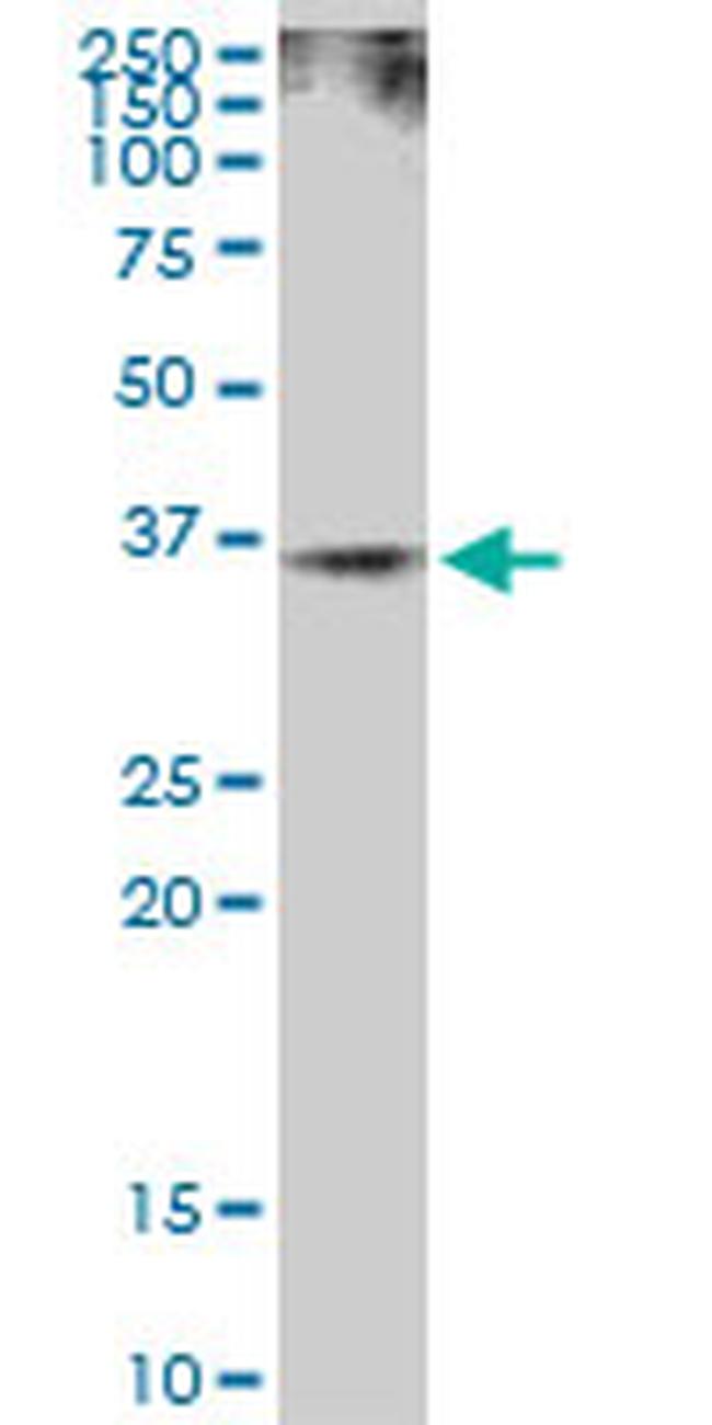 RAD51 Antibody in Western Blot (WB)