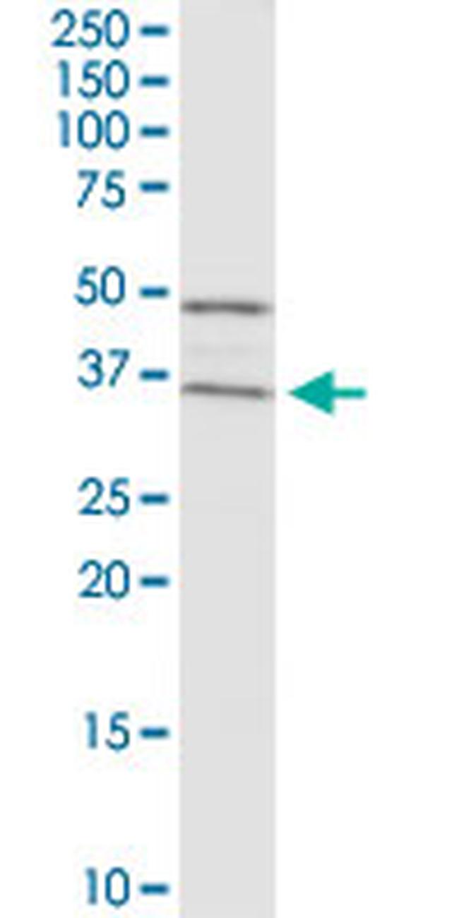 RAD51 Antibody in Western Blot (WB)