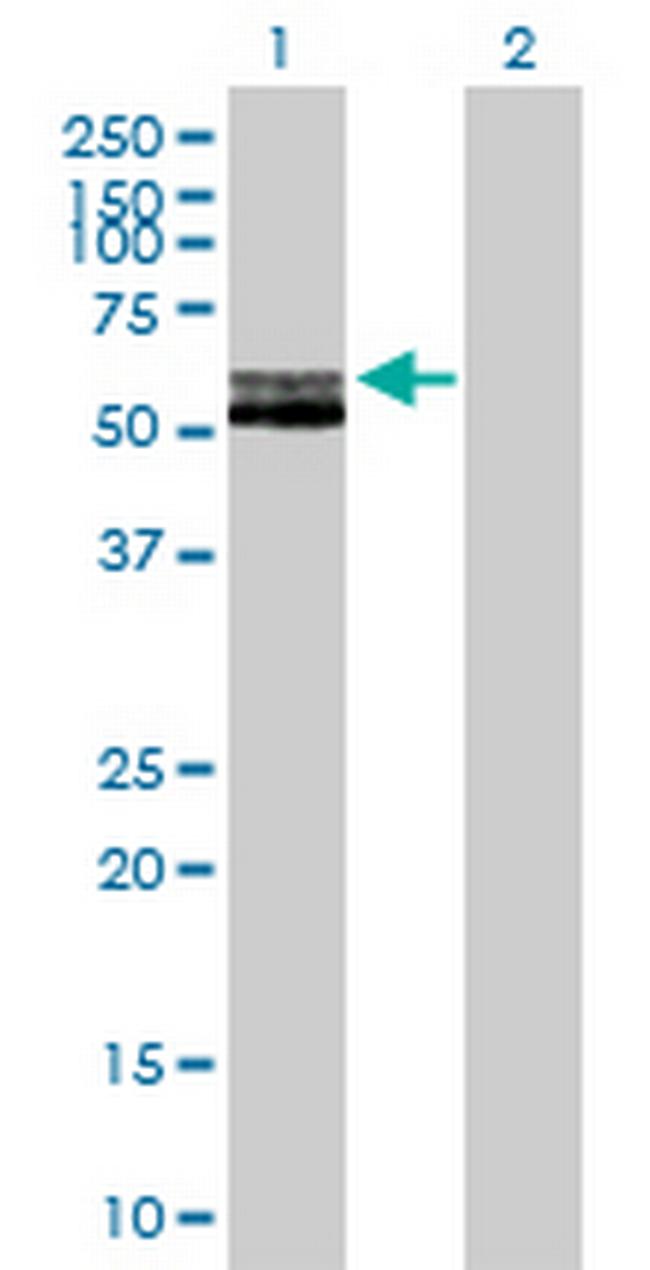 RAG2 Antibody in Western Blot (WB)