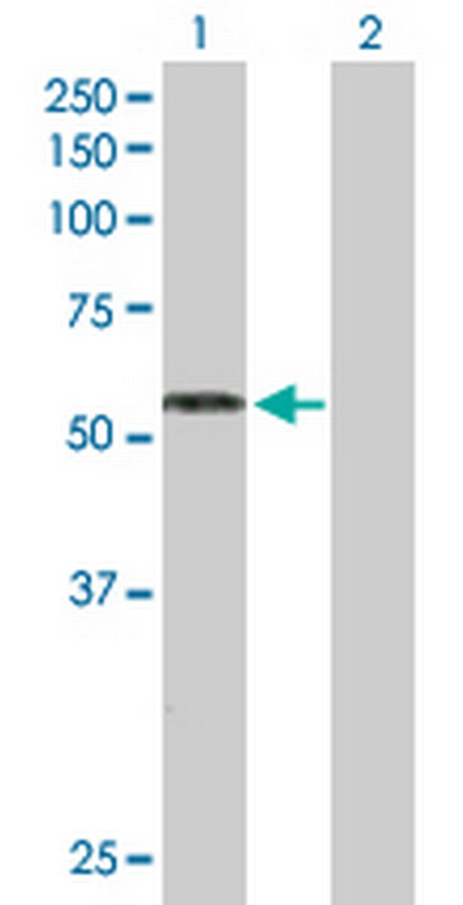 RAG2 Antibody in Western Blot (WB)