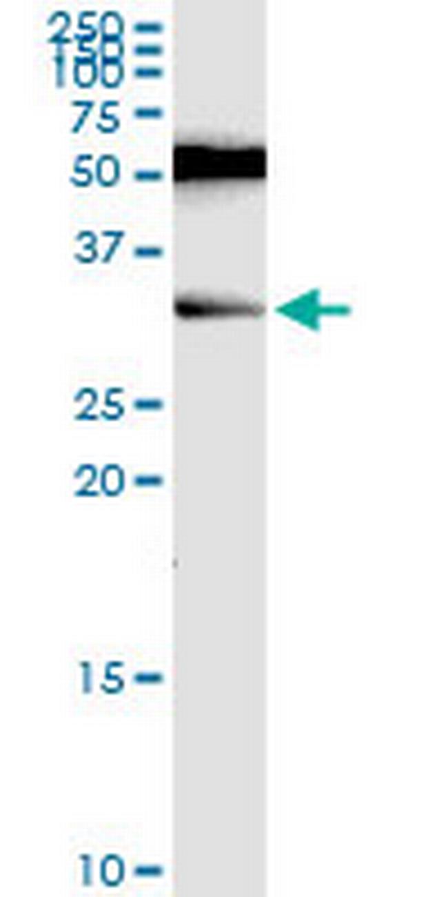 RAG2 Antibody in Western Blot (WB)