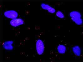 RALGDS Antibody in Proximity Ligation Assay (PLA) (PLA)