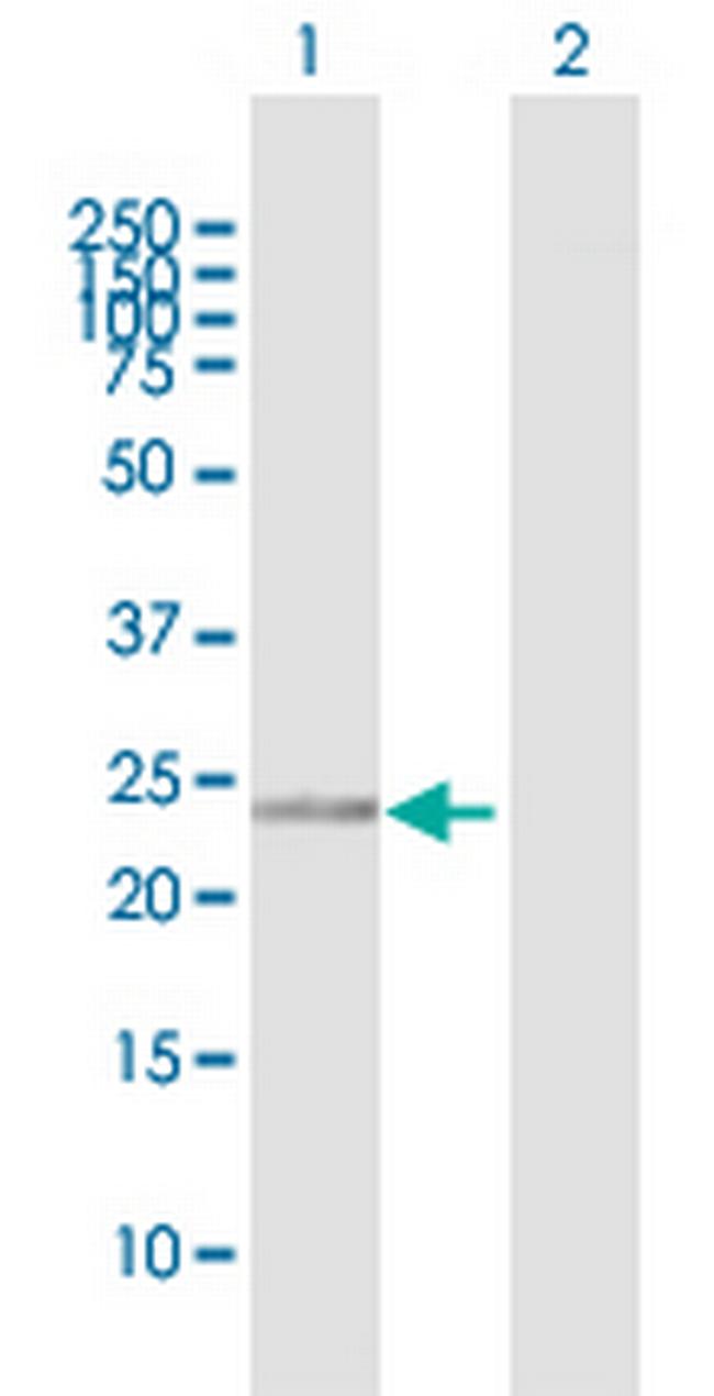 RANBP1 Antibody in Western Blot (WB)