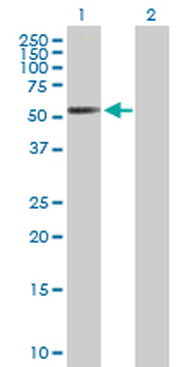 RARB Antibody in Western Blot (WB)