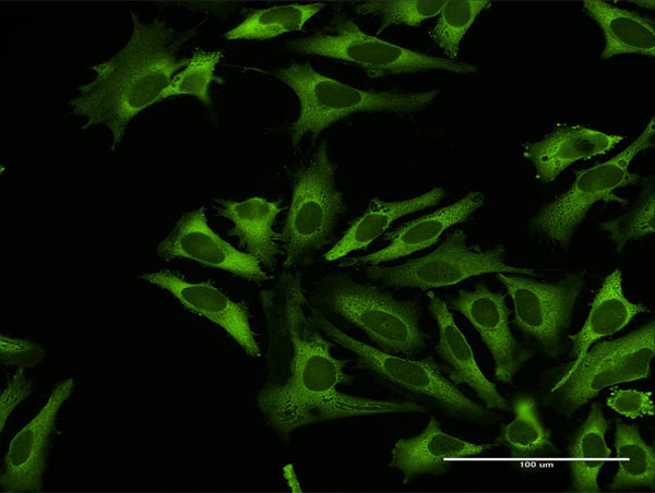 RARS Antibody in Immunocytochemistry (ICC/IF)