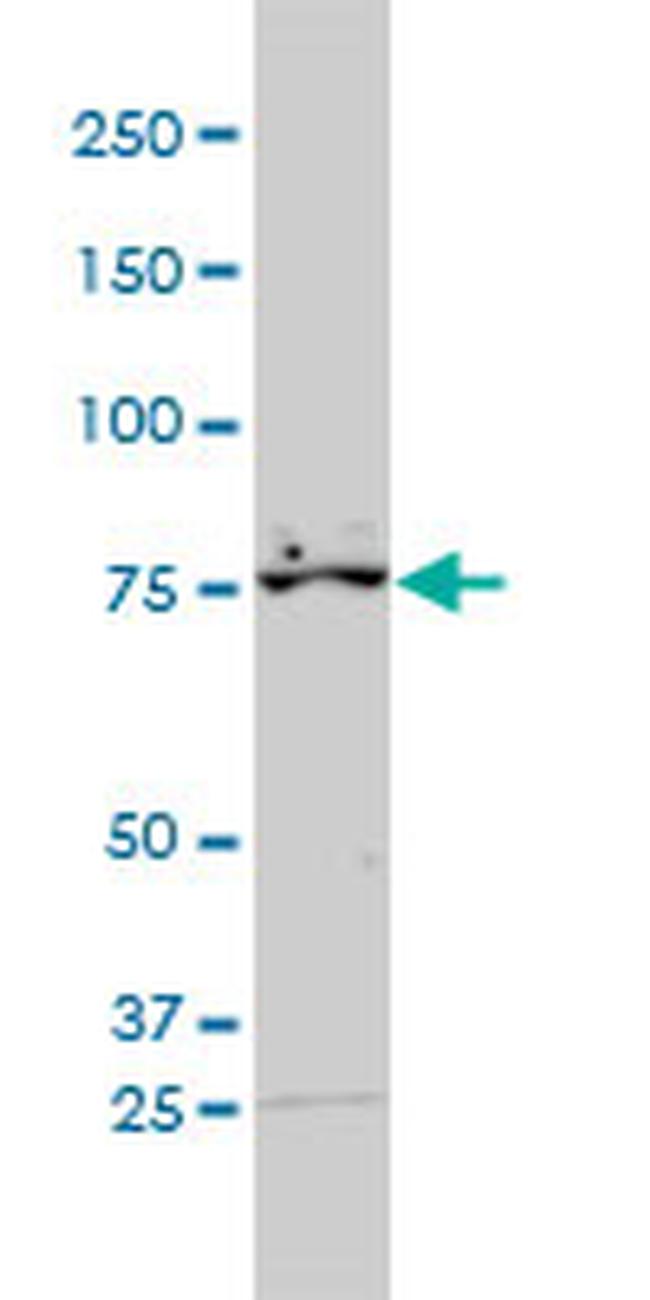 RARS Antibody in Western Blot (WB)