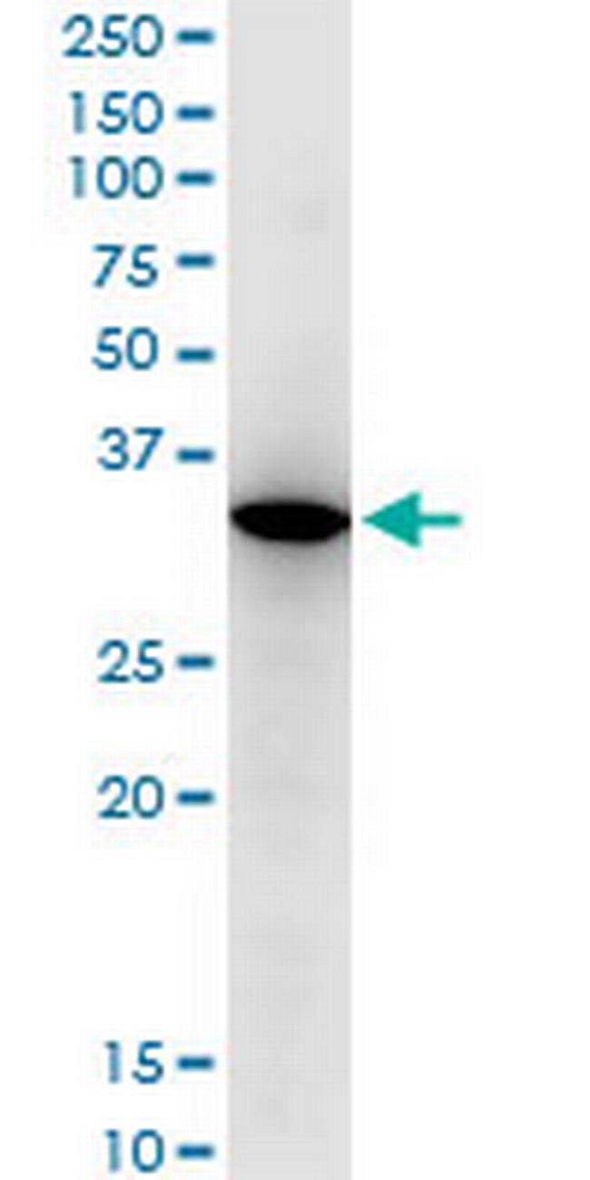 RARRES1 Antibody in Western Blot (WB)