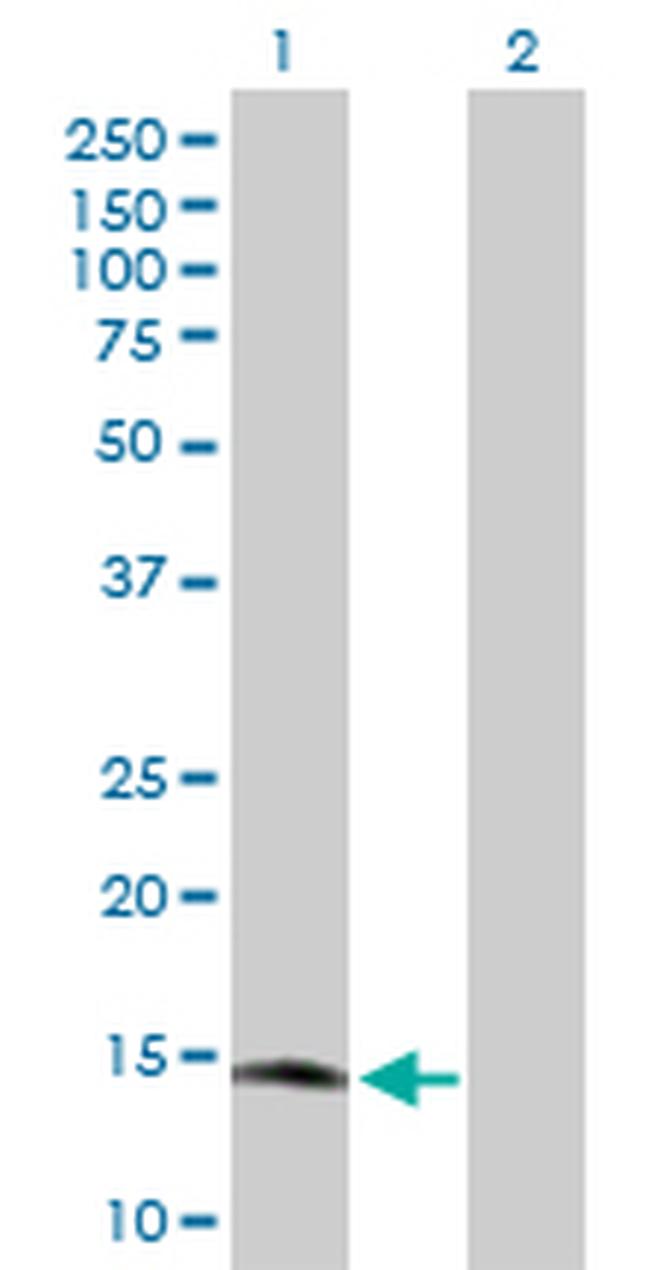 RARRES2 Antibody in Western Blot (WB)