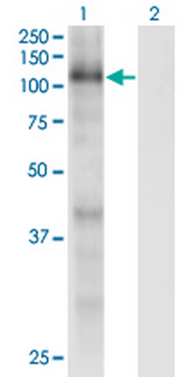 RBL1 Antibody in Western Blot (WB)