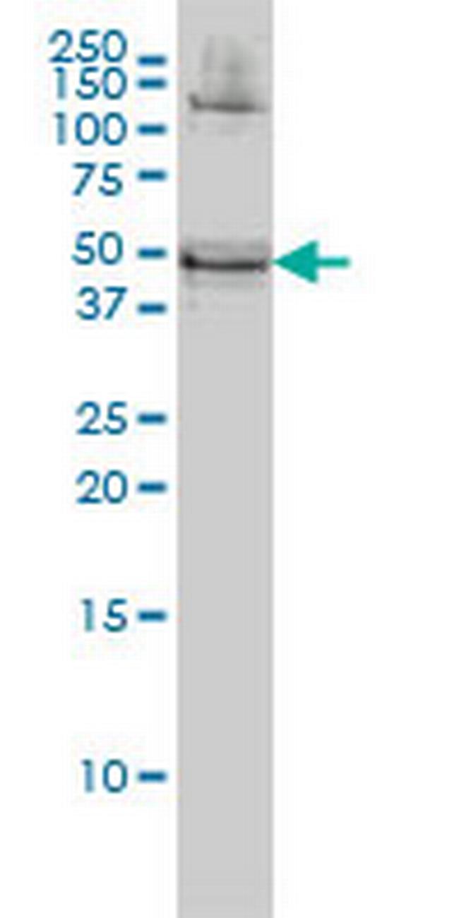 RBMS1 Antibody in Western Blot (WB)