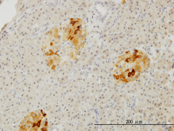 RBP4 Antibody in Immunohistochemistry (Paraffin) (IHC (P))