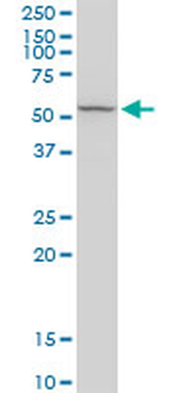 RCN2 Antibody in Western Blot (WB)