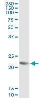 RCV1 Antibody in Immunoprecipitation (IP)