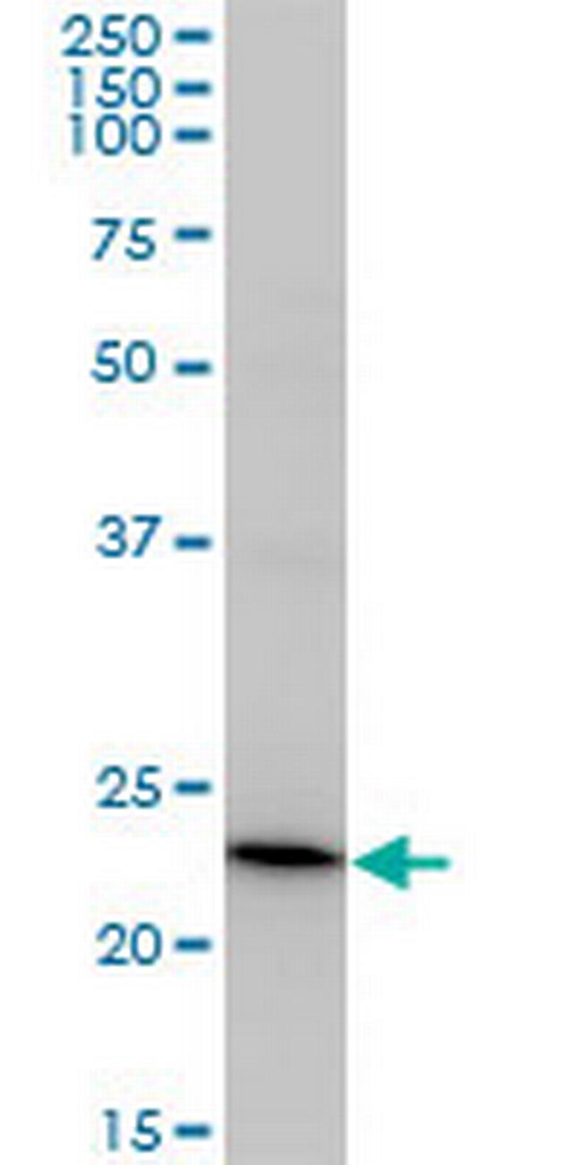 RCV1 Antibody in Western Blot (WB)