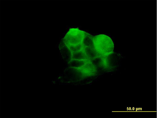 RDX Antibody in Immunocytochemistry (ICC/IF)