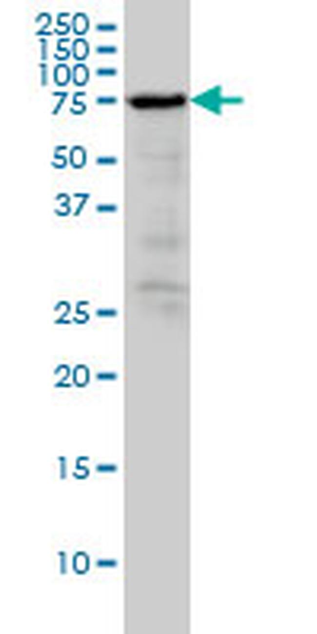 RDX Antibody in Western Blot (WB)