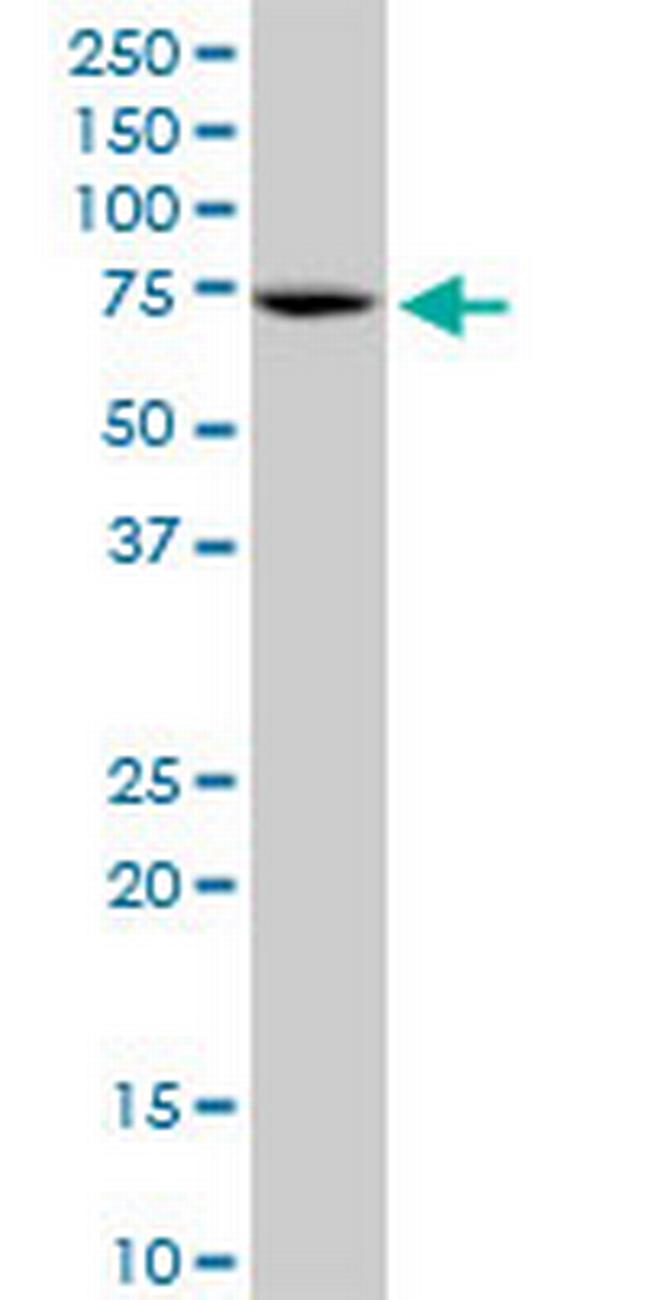 RECQL Antibody in Western Blot (WB)