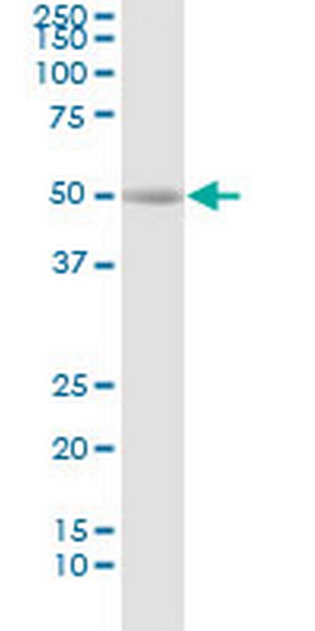 REN Antibody in Western Blot (WB)