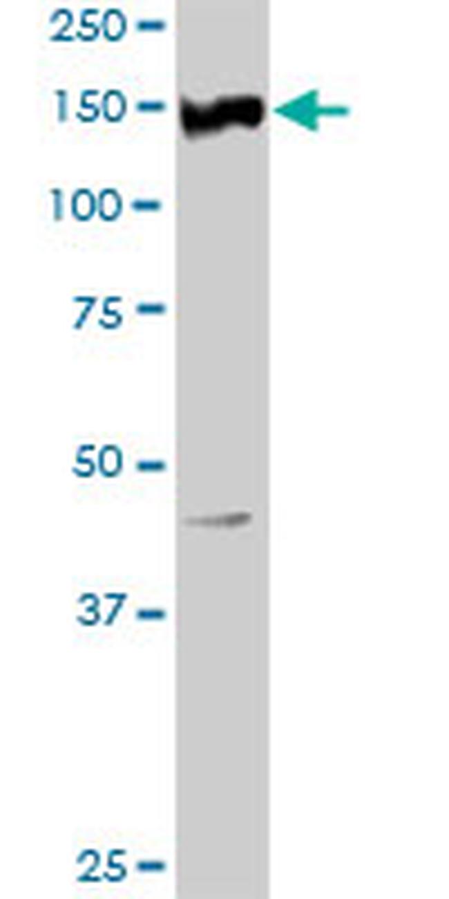 RET Antibody in Western Blot (WB)