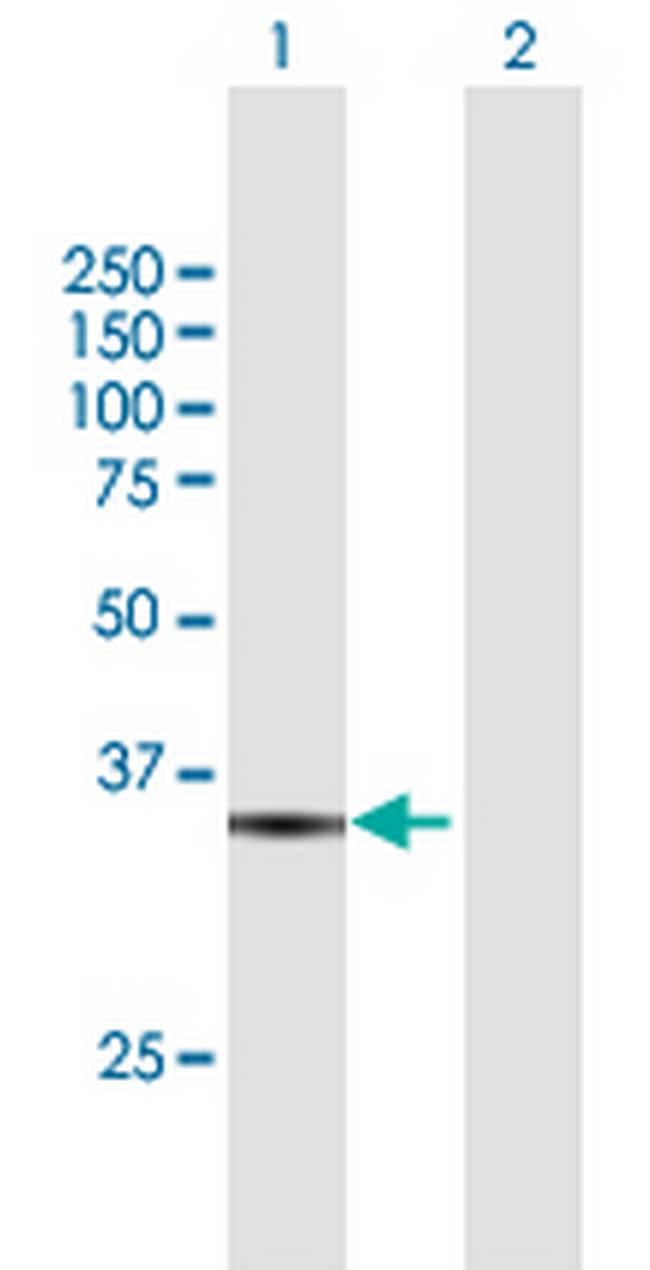 RFC5 Antibody in Western Blot (WB)