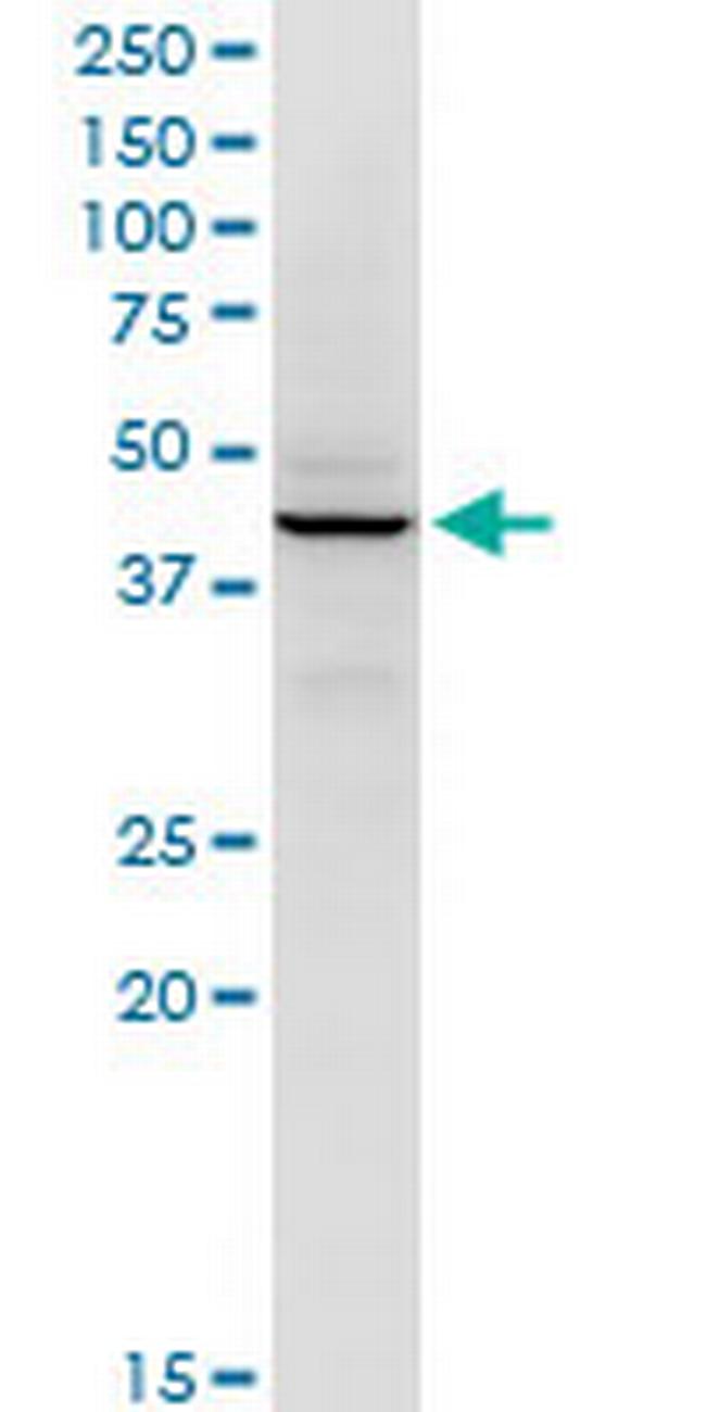 RFC5 Antibody in Western Blot (WB)