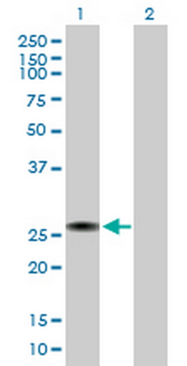 RGS2 Antibody in Western Blot (WB)