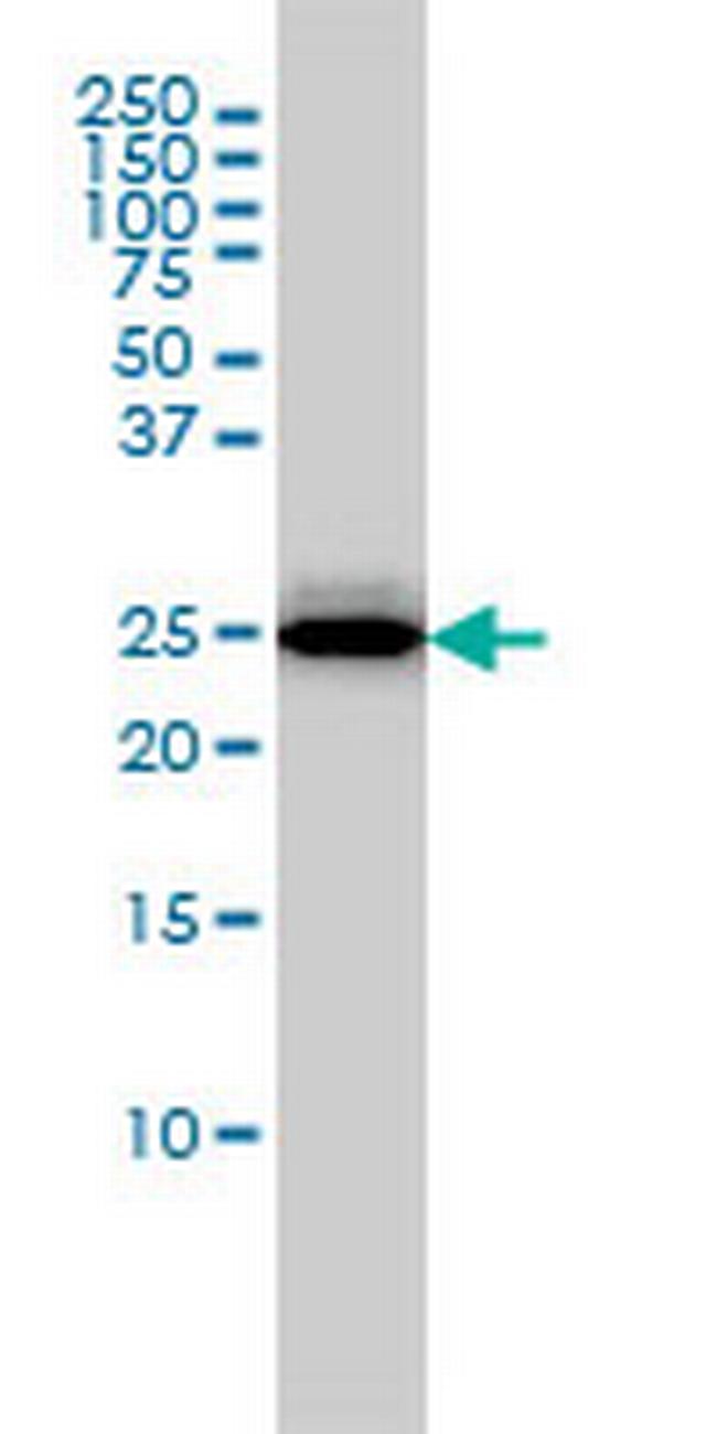 RGS2 Antibody in Western Blot (WB)