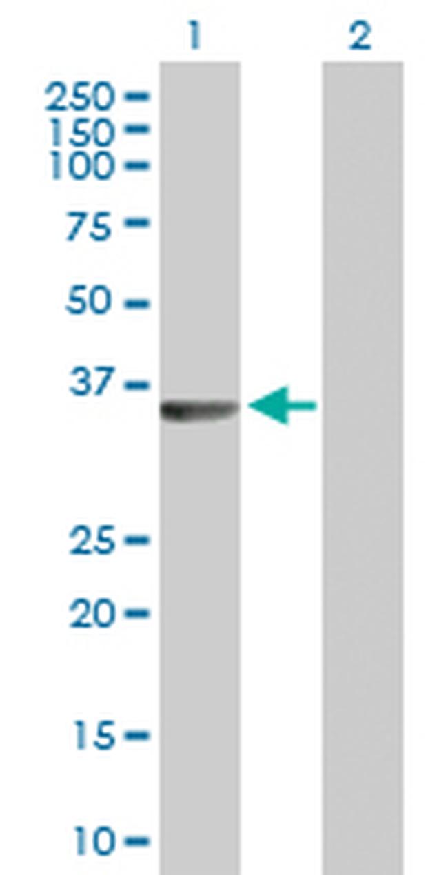 RLBP1 Antibody in Western Blot (WB)