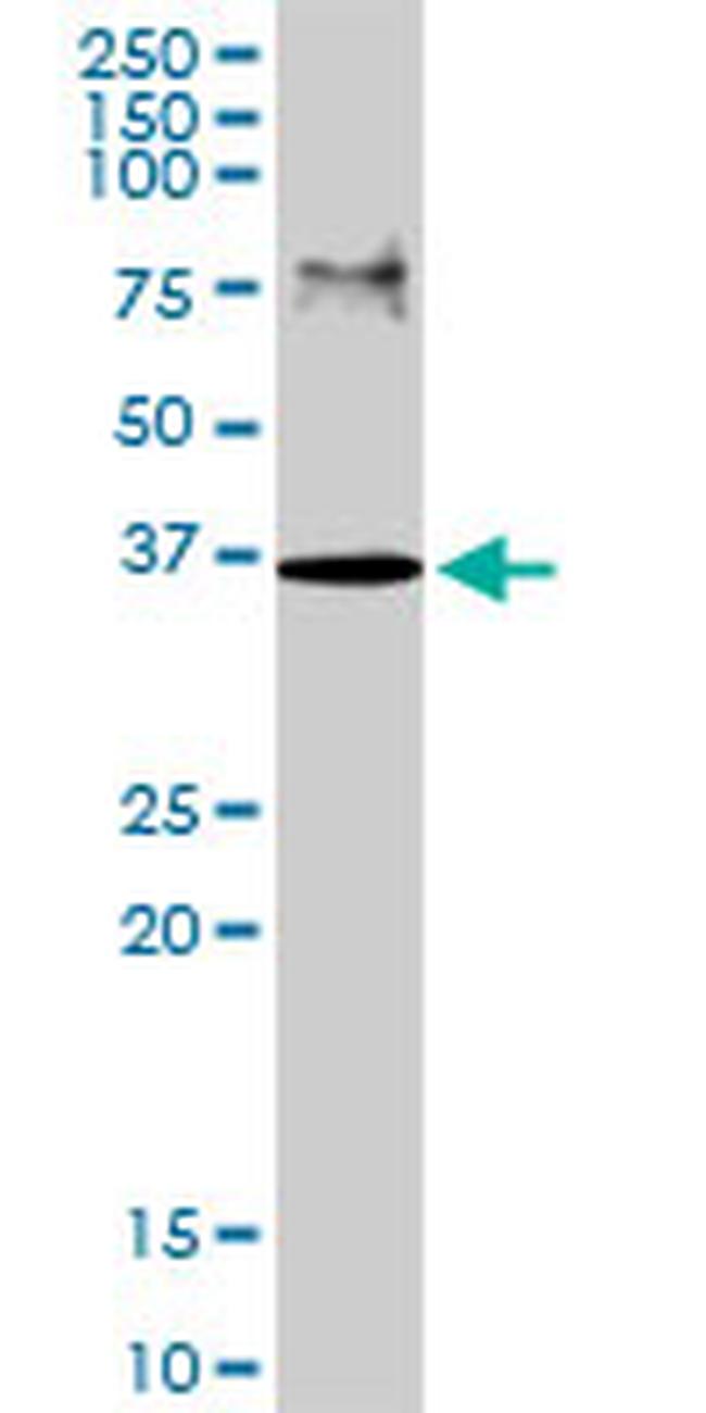 RLBP1 Antibody in Western Blot (WB)