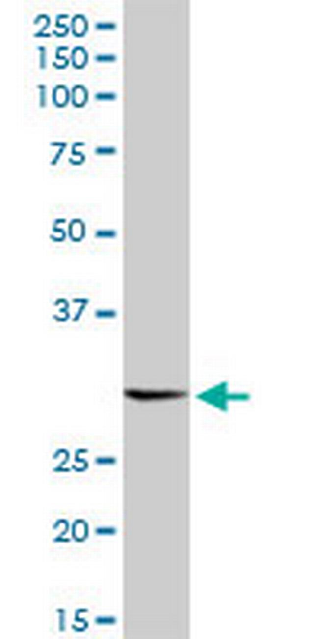 RNF2 Antibody in Western Blot (WB)